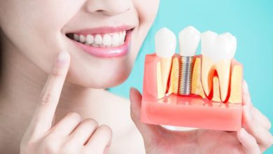 How To Care For Your Dental Implants After Surgery
